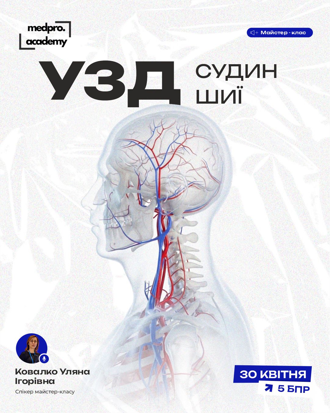 3УЗД судин шиї